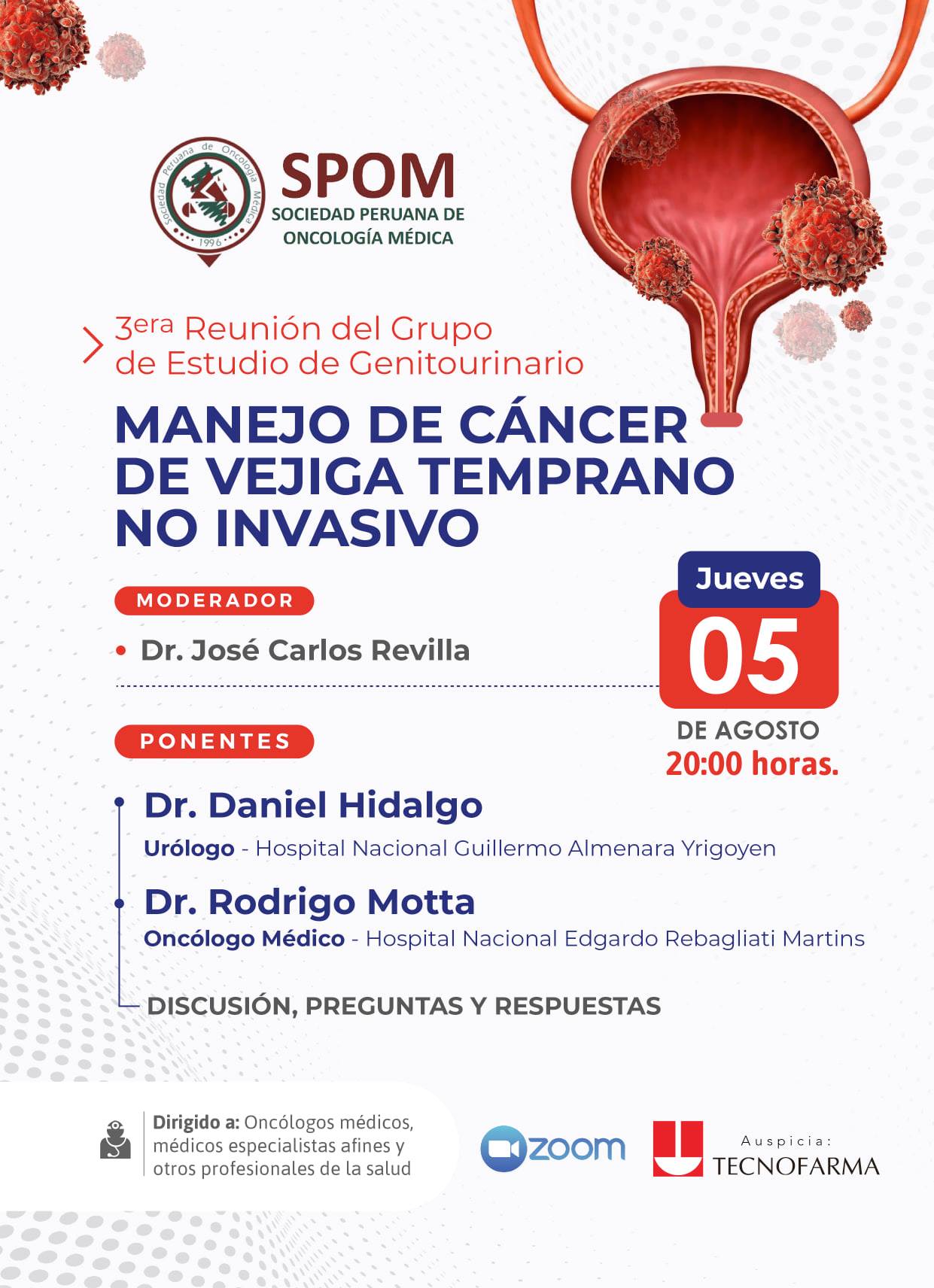 manejo-dedl-cancer-de-vejiga-.jpg